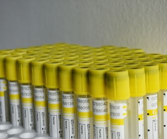 side image for CALCIUM (Ca) - 1