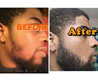 side image for Nourishing Beard Oil  - 2