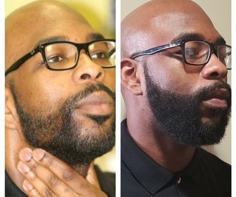 side image for Nourishing Beard Oil  - 3