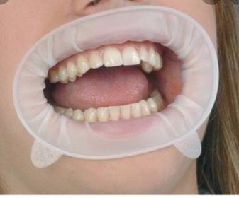 side image for ABRIDOR DE BOCA OPTRAGATE REGULAR REFIL C/1 IVOCLAR - 1