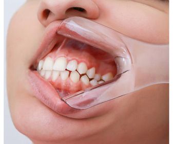side image for AFASTADOR LABIAL P/ FOTOGRAFIA V TRANSP TAM G C/2 INDUSBELLO - 3